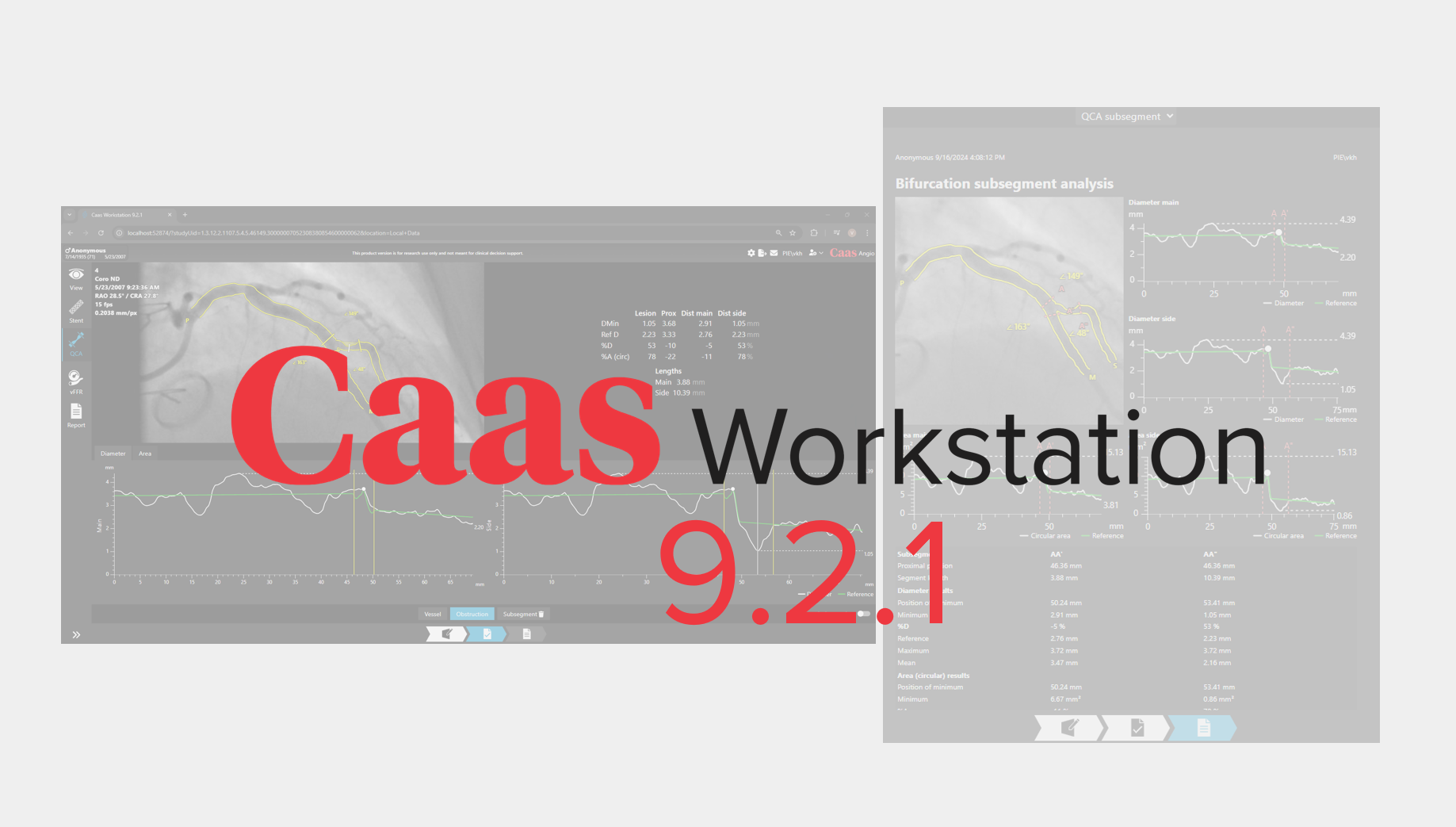 Caas Workstation 9.2 release :: Pie medical imaging