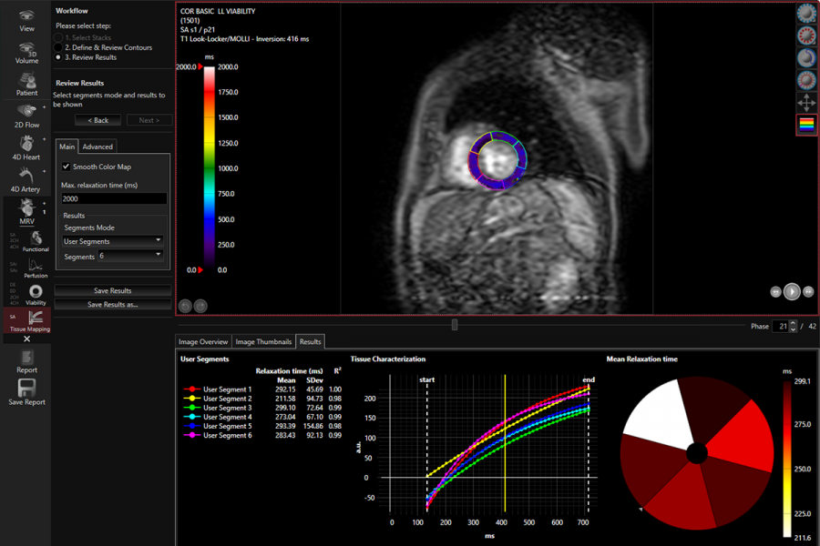 Tissue Mapping T1