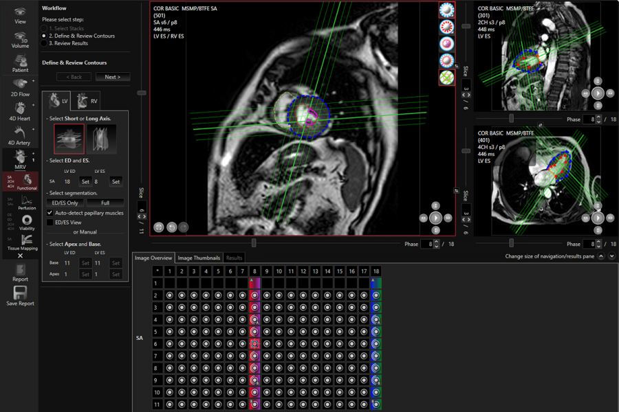 Define and Review Contours