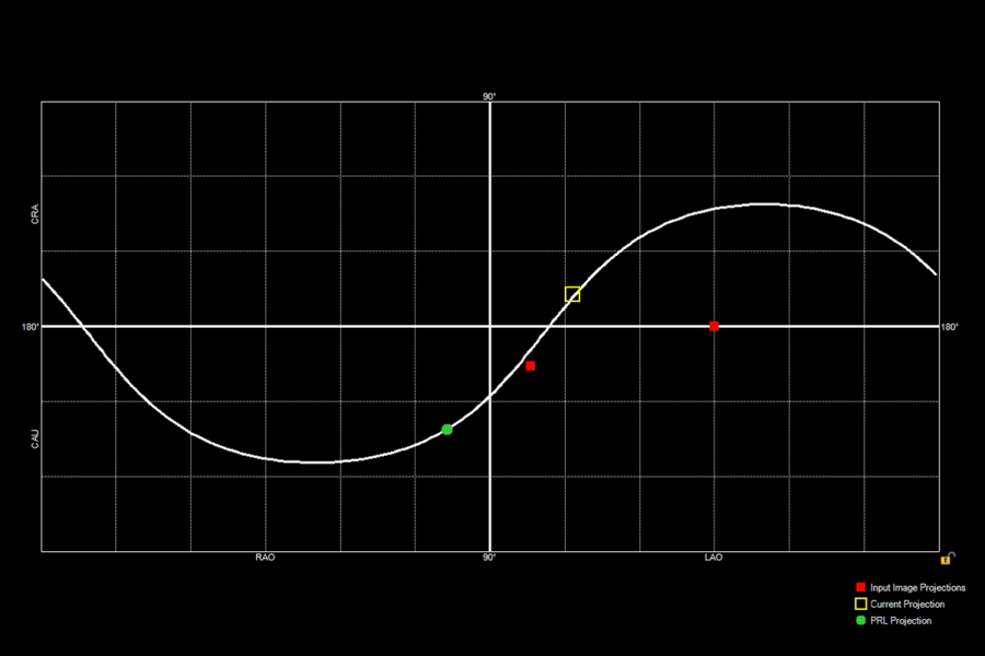 PRL graph projection