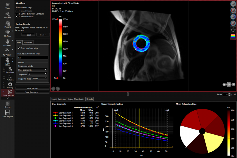 Tissue Mapping T2