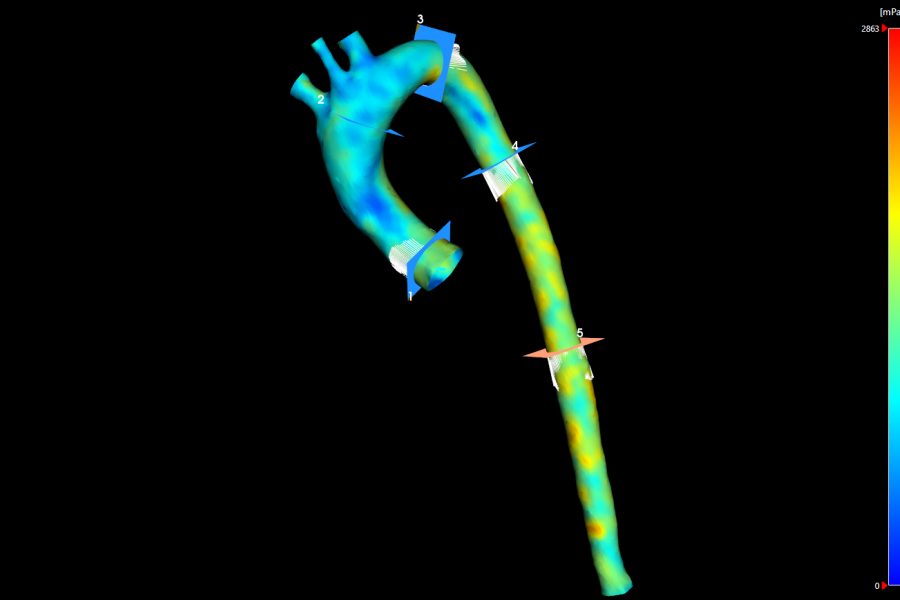 Wall Shear Stress