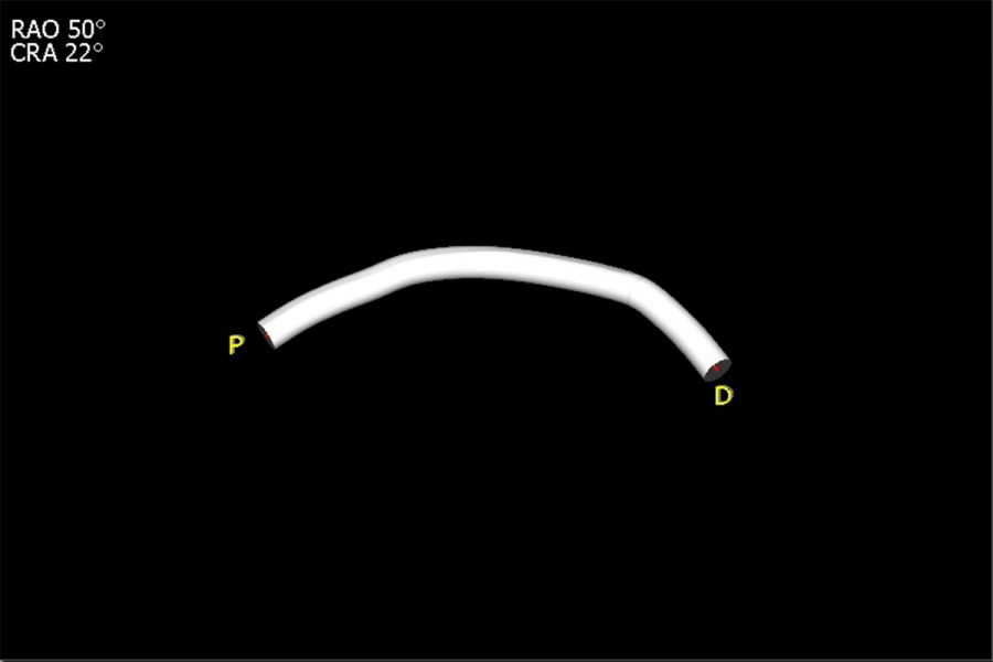 Catheter path