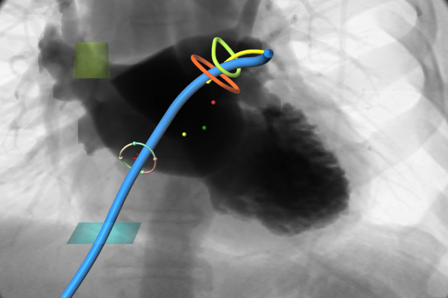 Septal crossing