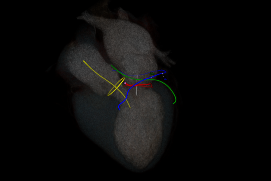 Mitral overview structures